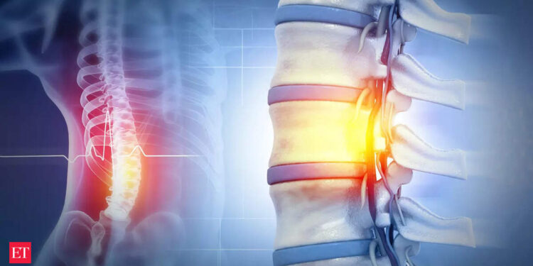 Regenerative Medicine: Israel will launch the first human spinal cord transplantation in the world using patient cells themselves