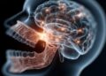 Poor oral health linked to markers of brain damage Poor oral health linked to markers of brain damage