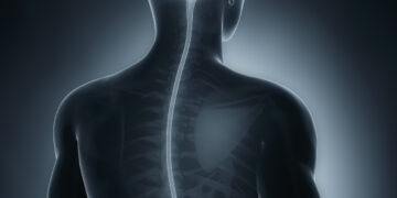 New imaging approach may improve spinal cord injury treatment New imaging approach may improve spinal cord injury treatment