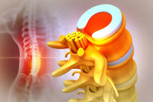Human spinal cord injury, back pain on blurred background. 3d illustration