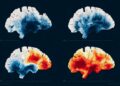 fMRI signals often misinterpret neural activity