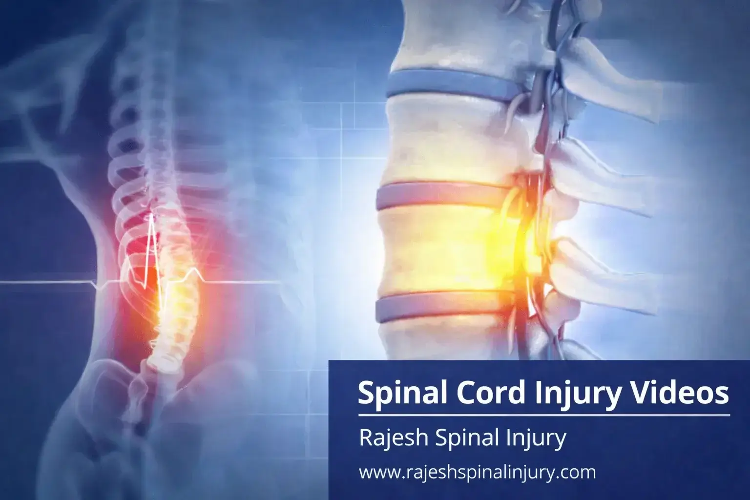 Spinal Cord Injury Videos